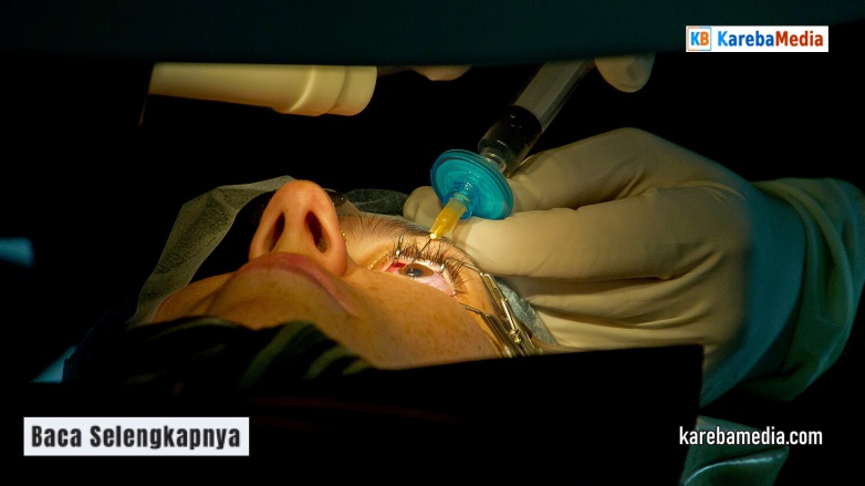 Syarat LASIK Mata Minimal Minus Berapa? Cek Batasannya!